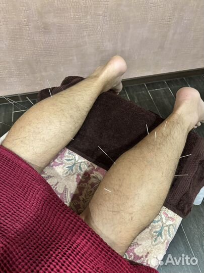 Массаж массажист акупунктура