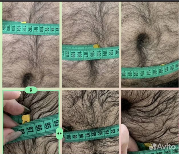 Похудение для мужчин и женщин Криолиполиз Москва