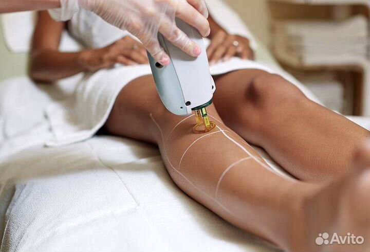 Готовый бизнес: студия лазерной эпиляции