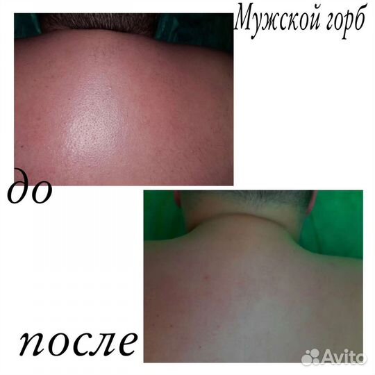 Массаж(профессиональный) ручной