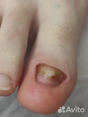 Услуги подолога