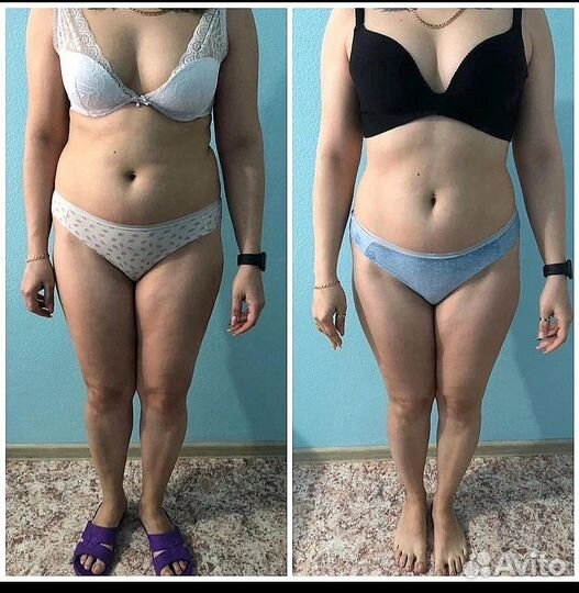 Хотите стройное тело Похудение 9 процедур