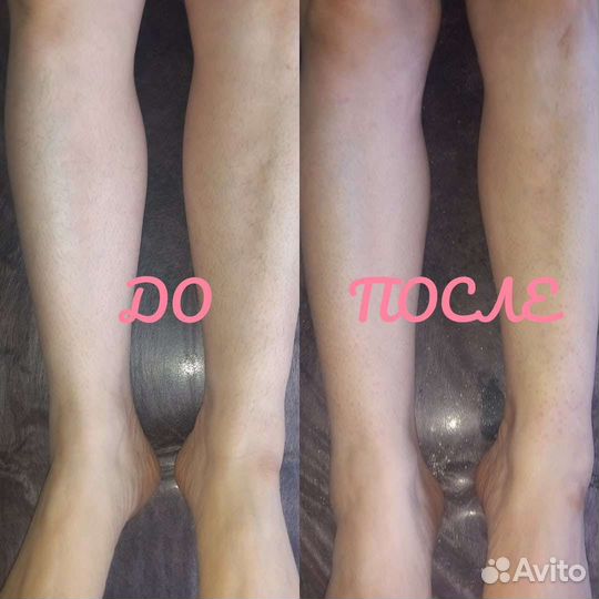 Модели на шугаринг