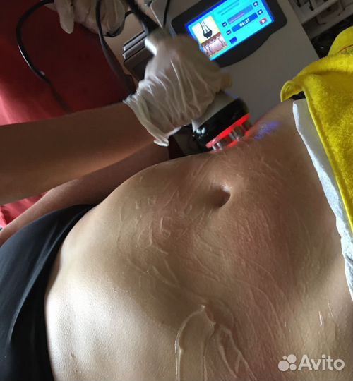 Массаж, аппаратная коррекция фигуры