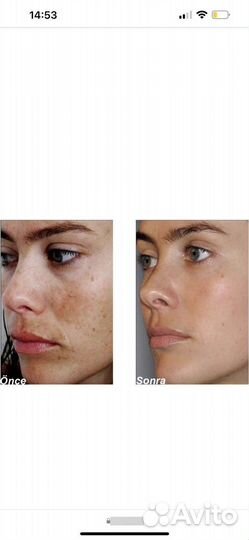 Пилинг mediderma ретиноловый
