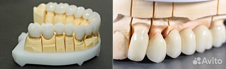 Фрезеровка циркония и 3D моделирование