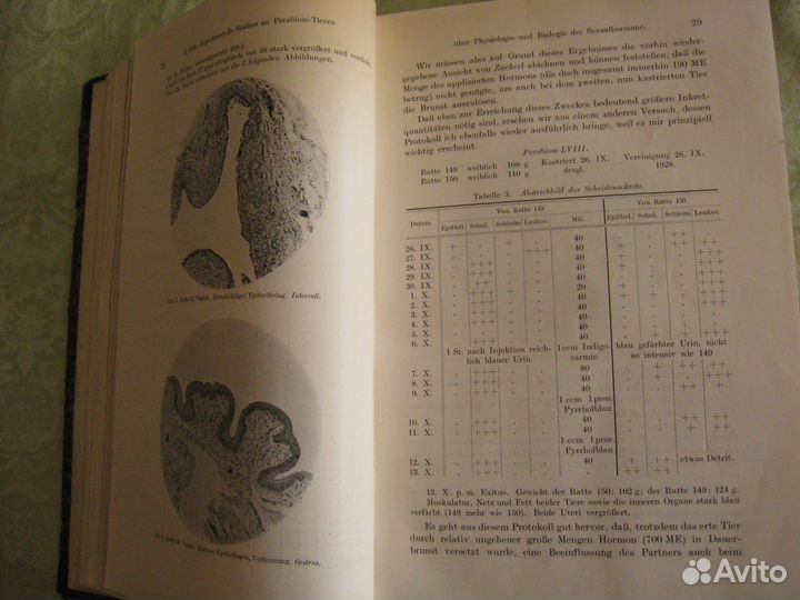 Книга антикварная по медицине гинекология 1929 год