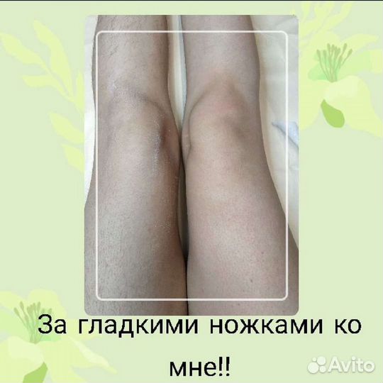 Депиляция
