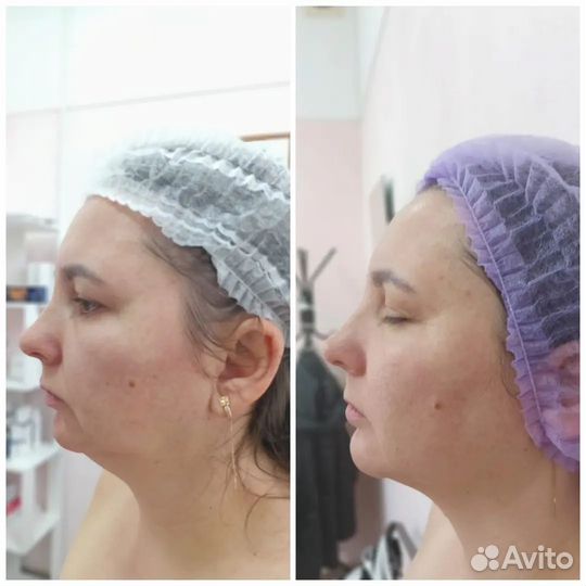 Услуги косметолога