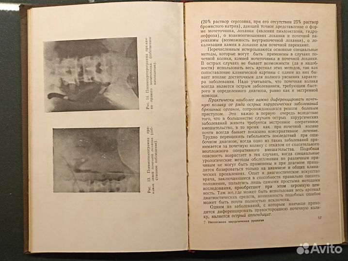 Неотложная хирургическая урология. Соболев. 1954