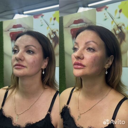 Требуются модели на нити. Косметолог