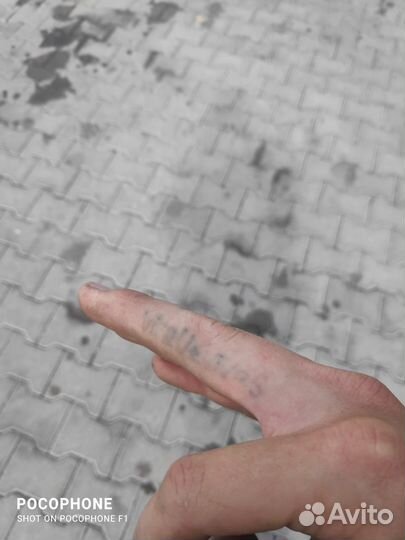 Лазерное удаление татуировок