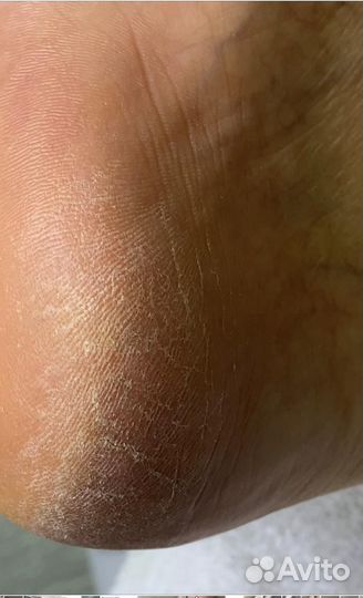 Смарт педикюр в студии