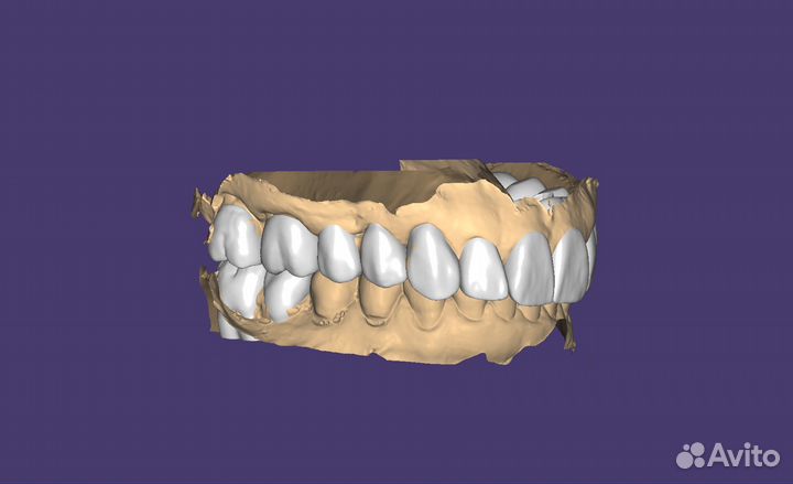 3d моделирование exocad