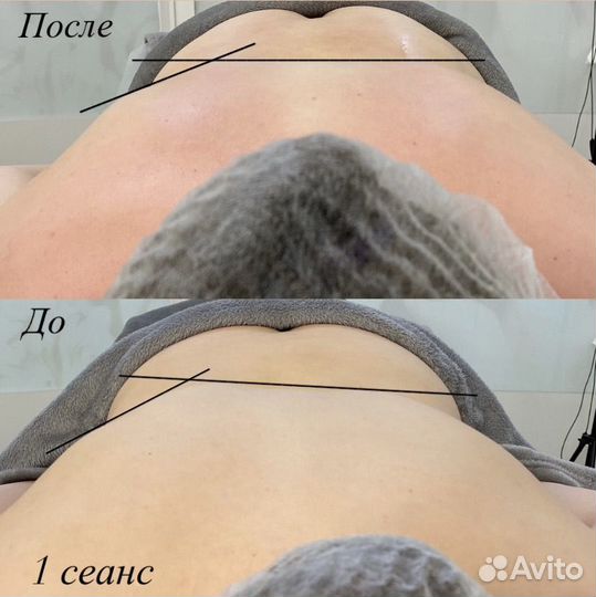 Обучение массажу
