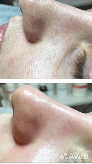 Массаж Депиляция Косметология