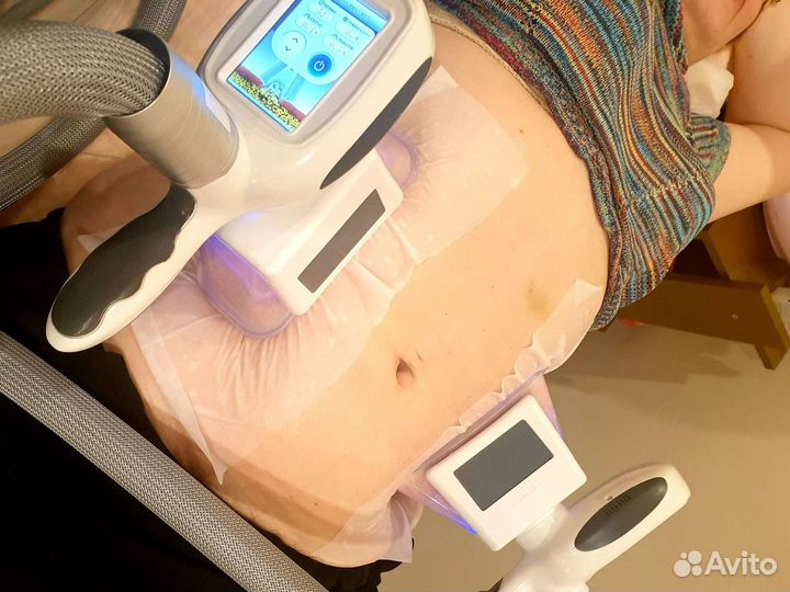 Криолиполиз,антицеллюлитный массаж