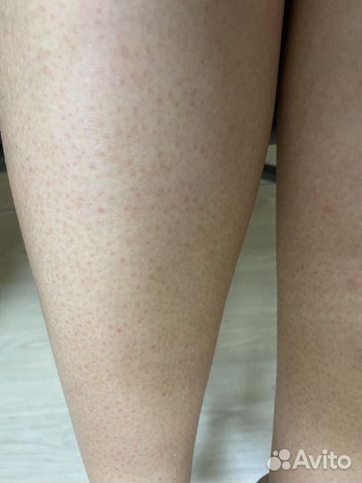 Услуги шугаринга