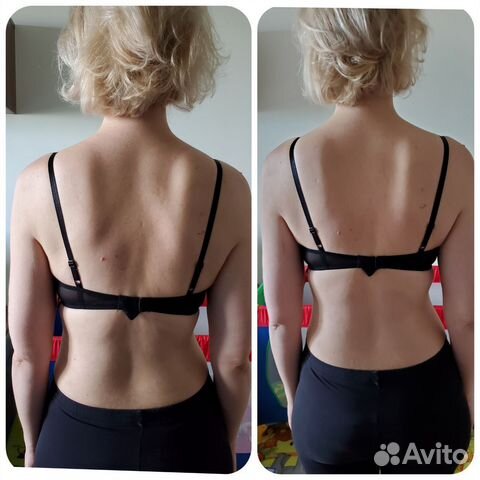 Прикладная кинезиология. Коррекция родовой травмы