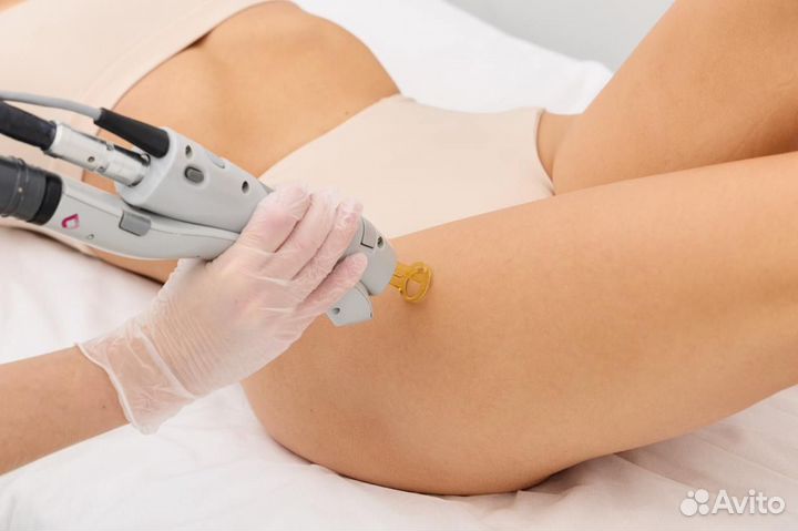 Лазерная эпиляция / Александритовый лазер