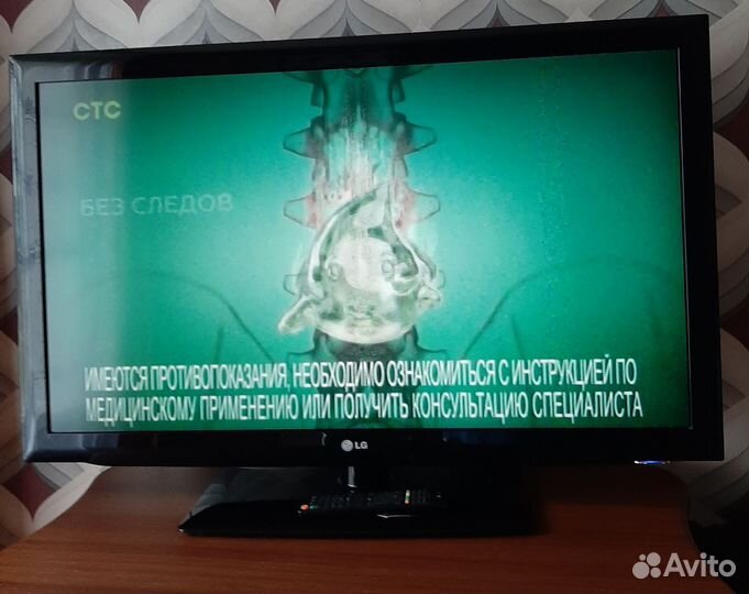 Телевизор LG