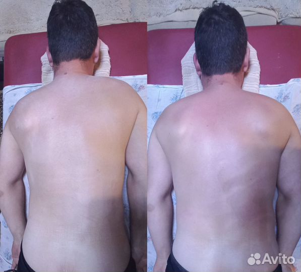 Остеопатическая коррекция, остеобаланс