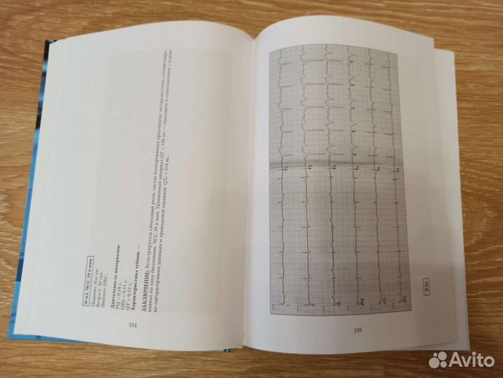 Медицинская литература. Экг