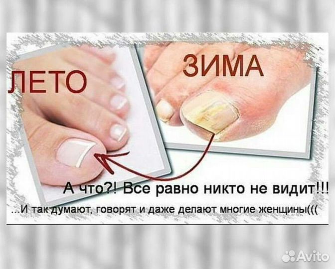 Педикюр
