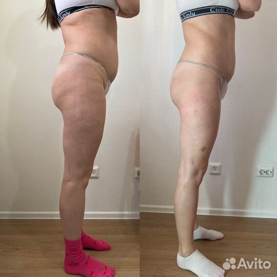 Массаж лица и тела