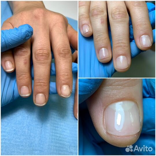 Педикюр,подологические услуги с выездом на дом