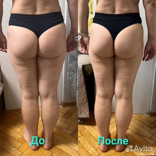 Массаж Профессионал