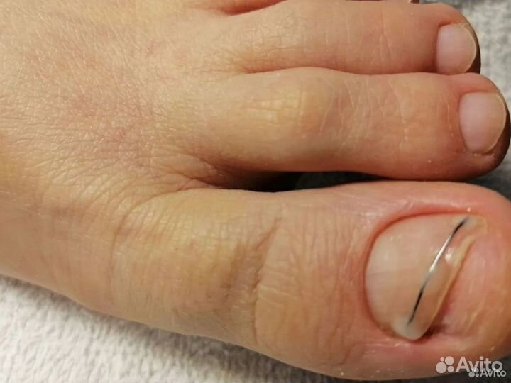 Педикюр/ Работа со сложной стопой