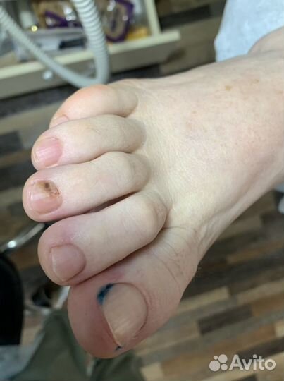 Подолог / Лечебный педикюр / Медицинский педикюр