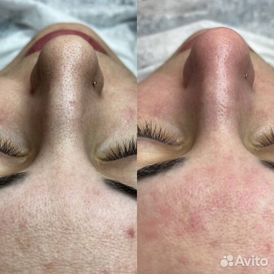 Врач - косметолог