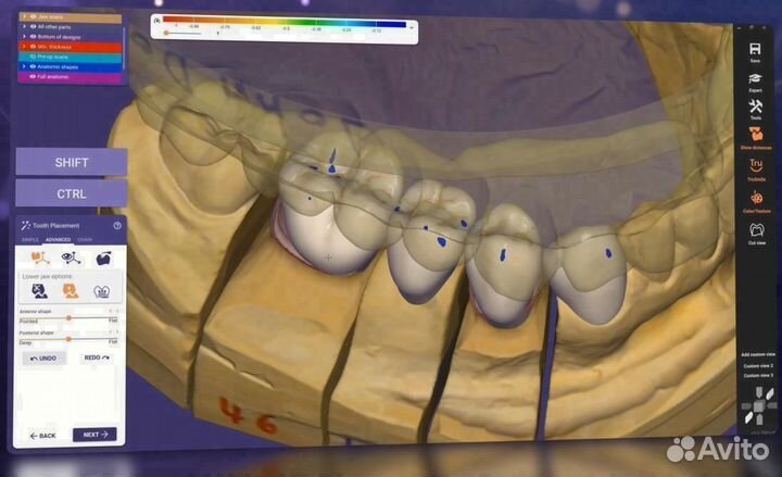 Hyperdent/3shape/ExoCad/Biblioteki Geo/PlastyCad