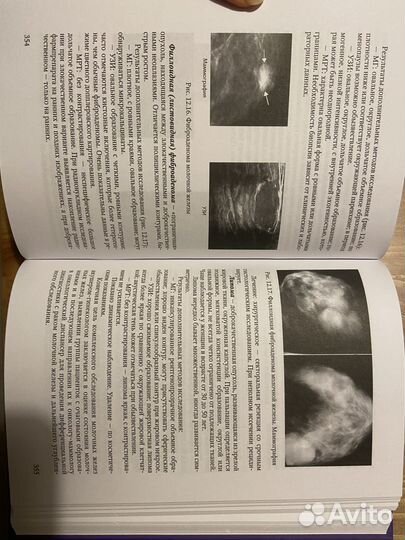 Гинекология Шмидт А. А. спецлит