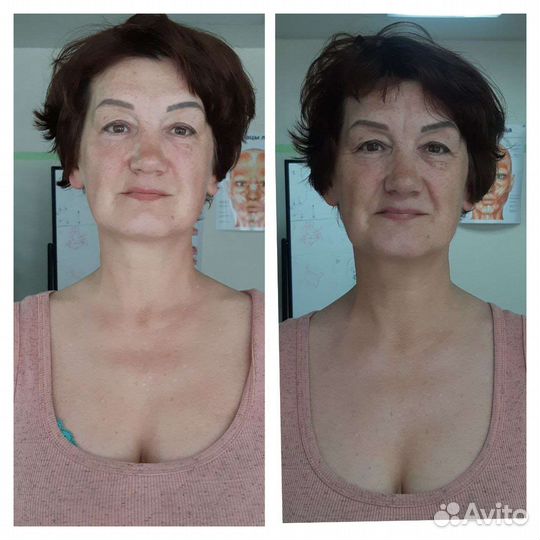 Услуги косметолога-эстетиста