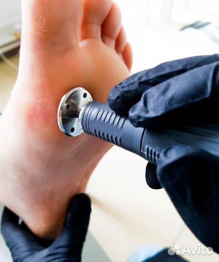 Карбамидный педикюр