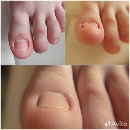 Подолог, педикюр