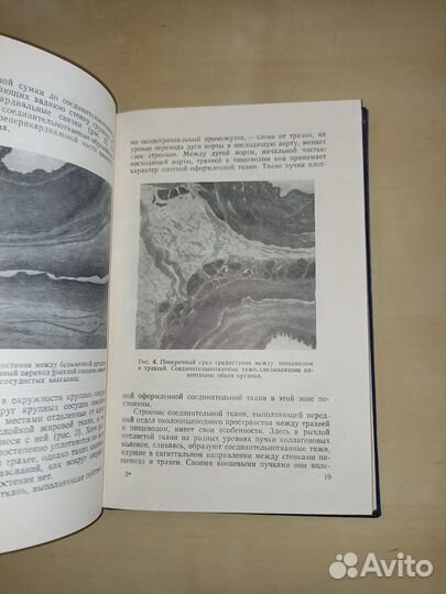 Абсцессы и флегмоны средостения. Иванов. 1959