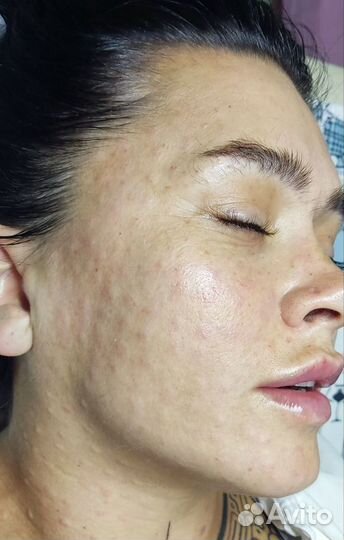 Услуги косметолога