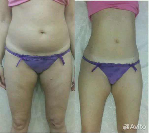 Коррекция фигуры и лица