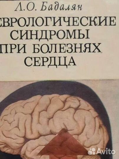 Неврологические синдромы при болезнях сердца.1975г