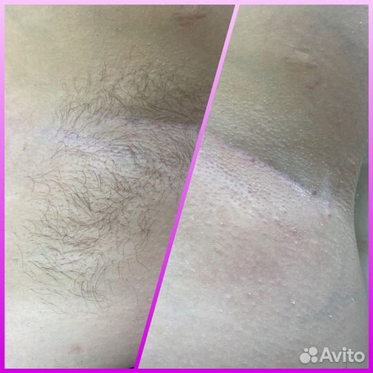 Модели на шугаринг пионерский