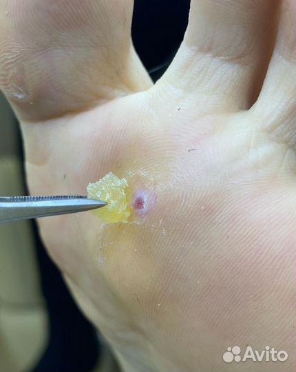 Подолог, мастер аппаратного педикюра