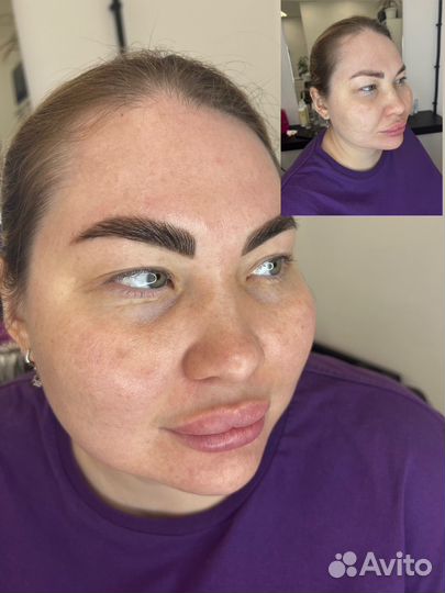 Модели на бьюти-процедуры