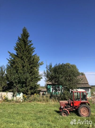 Ель живая полувековая пушистая. С шишечками