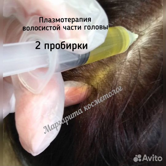 Косметолог/Челны/Плазмолифтинг/Плазмогель