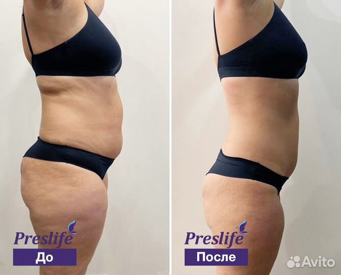 Кoмплeкс для похудения. Прощай живот. Прощай живот