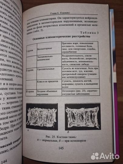 Серпионова Л.А. 100 интимных вопросов к гинекологу